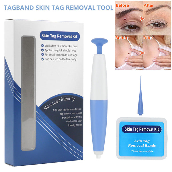 TagBand Skin Tag Remover Kit
