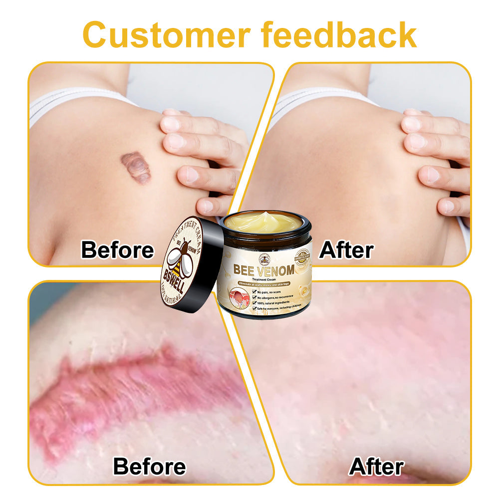 BSWELL™ Bee Venom Cream