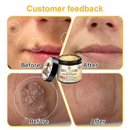 BSWELL™ Bee Venom Cream