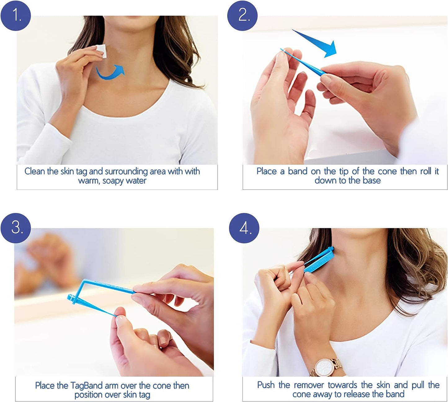 TagBand Skin Tag Remover Kit